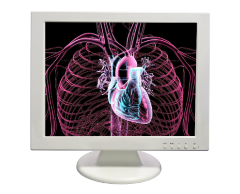 medical monitor